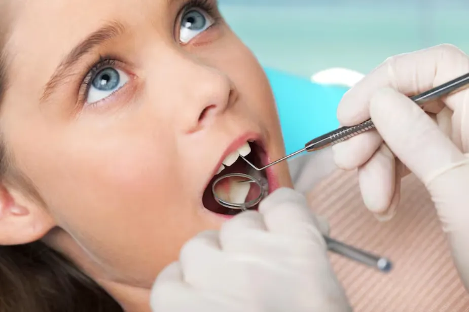 delaying cavity filling risks